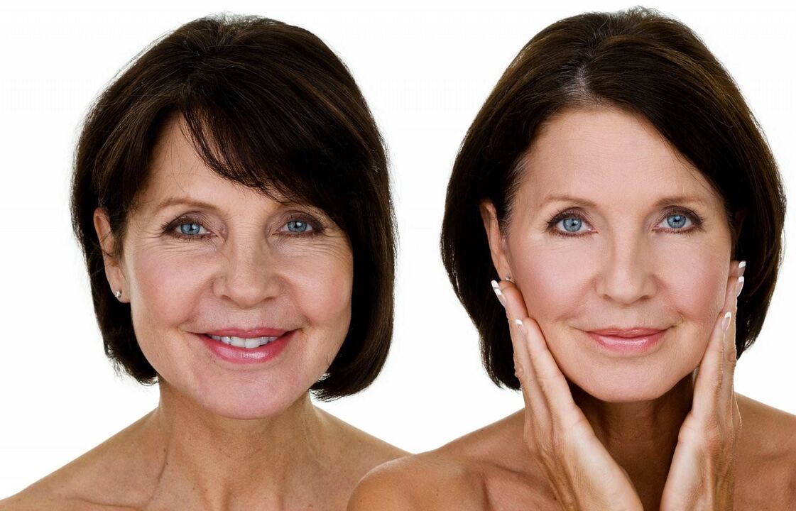 Rejuvenecimiento de la piel facial