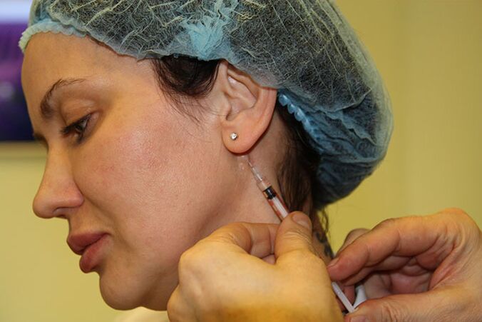 Corrección ovalada facial con rellenos