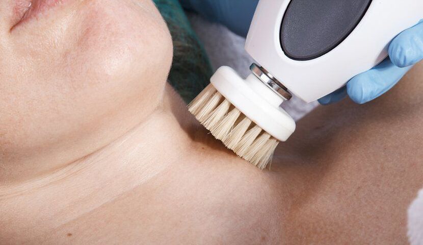 Cuello de refuerzo